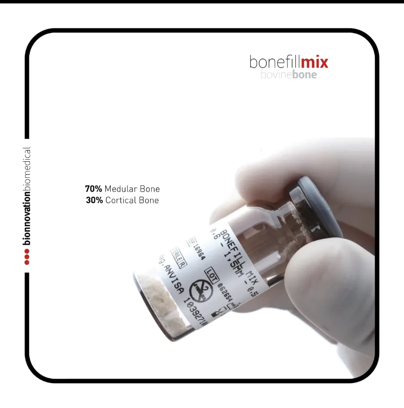 Enxerto Bonefill Mix - Bionnovation - Imagem 2